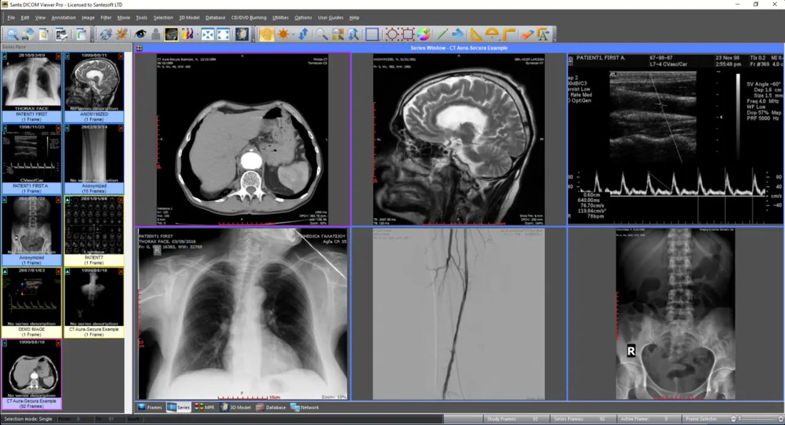 Sante DICOM Viewer Pro 14.0.2 注册版 - 医学图像浏览器